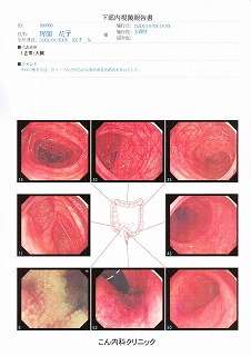 大腸検査報告書（患者用）